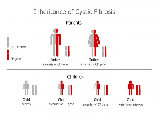 What is Cystic Fibrosis?